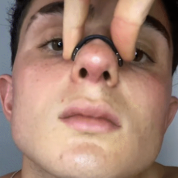 NasoFree Magnet Pro (Dilatador Nasal Magnético)